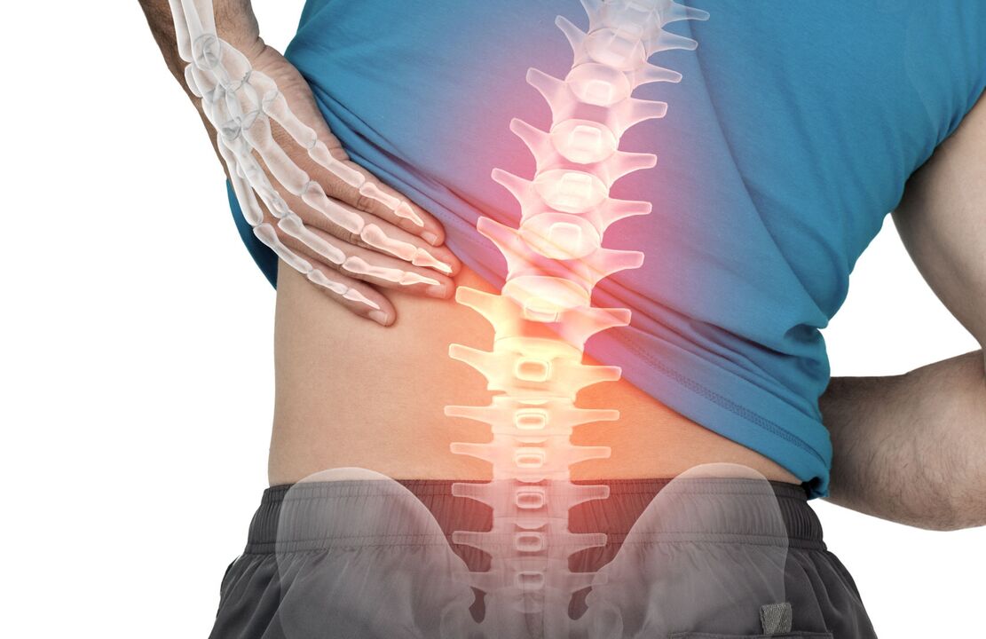 Il rischio di ostecondosi della colonna lombare
