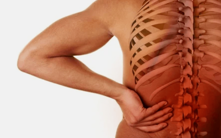 Le cause dell'osteocondosi della colonna lombare