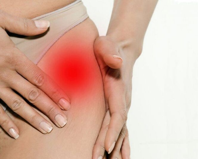 Dolore nell'area inguinale e cosce con osteoartrite dell'articolazione dell'anca