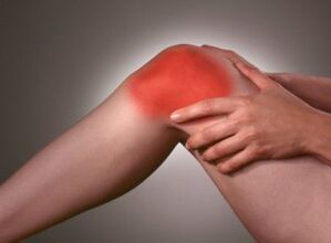 Il sintomo dell'osteoartrosi è un forte dolore nella zona del ginocchio